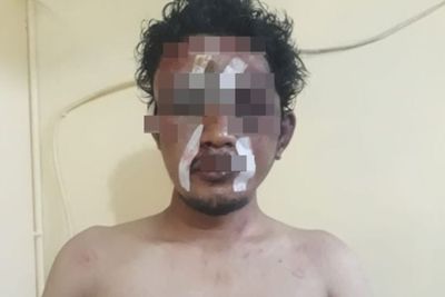 Aksi Pencurian Tak Berhasil, yang Dapat Malah Bogeman Massa, Babak Belur Jadinya, Duh!