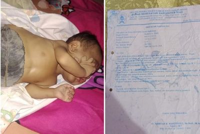 Bayi Lahir Tanpa Empedu di Gunung Sitoli Ini Butuh Pertolongan