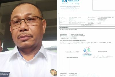 Plt Wali Kota Medan Positif COVID-19, Ini Riwayat Perjalanannya Sebelum Dirawat di RS