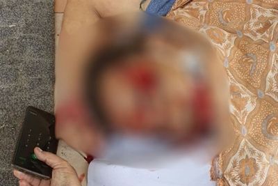 Luka Tembak yang Tewaskan Pengusaha di Jakut Terdapat di Dada Hingga Kepala