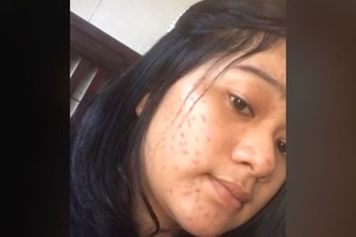 Cewek Prank Gebetan Pakai Filter Wajah Jerawatan, Reaksi si Cowok Diluar Dugaan