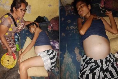 Empat Bulan Didiagnosa Kanker, Ira Faiza Lubis Butuh Bantuan untuk Berobat
