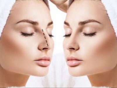 Bikin Merinding! Begini Kondisi Wanita Korban Gagal Operasi Hidung di Klinik Jaktim