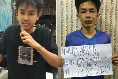 Pelaku Penusukan Syekh Ali Jaber Disebut Alami Gangguan Jiwa