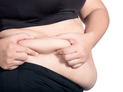 WHO: Lebih Dari 1 Miliar Orang di Dunia Menderita Obesitas