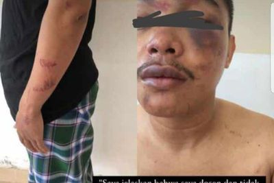 Pakar Hukum Kecam Insiden Dosen Makassar Diduga Salah Tangkap dan Dipukuli Oknum Polisi