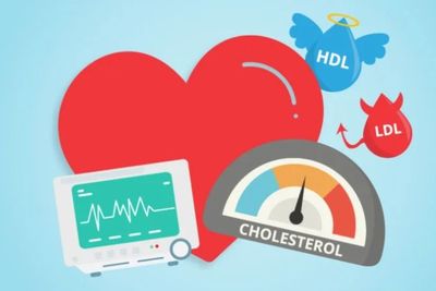 Dokter Ahli Jantung Bagikan 5 Gaya Hidup Sehat untuk Kendalikan Kolesterol