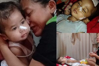 Radang Otak, Gadis Aurora Sempat Koma, Kini Tak Bisa Bergerak usai Tulang Sumsum Diambil