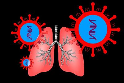 Paru-Paru Basah: Waspadai Kebiasaan Sehari-Hari yang Bisa Memicu Pneumonia