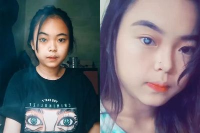 Viral Wanita Punya Mata Aneh Sebelah, Dikira Kelainan Ternyata Akibat Ini