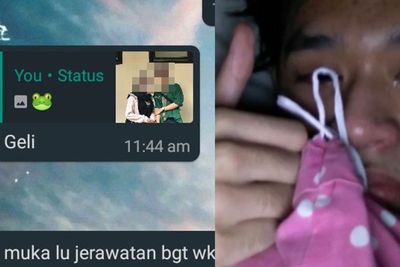 Nangis karena Wajah Berjerawatnya Diejek Teman, Cowok Ini Banjir Semangat