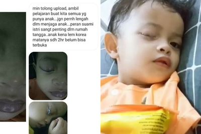 Kasihan, Bocah Ini Tidak Bisa Membuka Matanya selama 2 Hari karena Kena Lem Setan