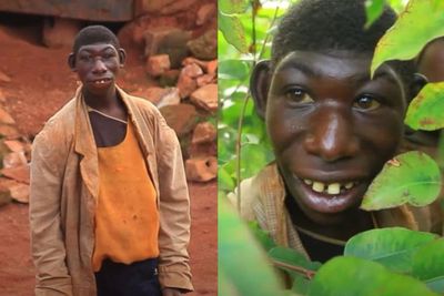 Zanziman Ellie, Mowgli di Dunia Nyata yang Sering Dibully Sampai Pilih Hidup di Hutan