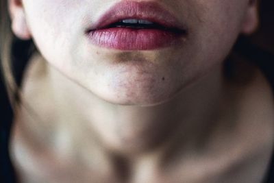 Atasi dengan 3 Bahan Alami Ini saat Bibir Pecah-pecah di Musim Dingin