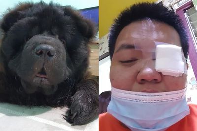 Tak Sengaja Lukai Mata Majikannya, Anjing Ini Begitu Khawatir, Ngecek Tiap Jam