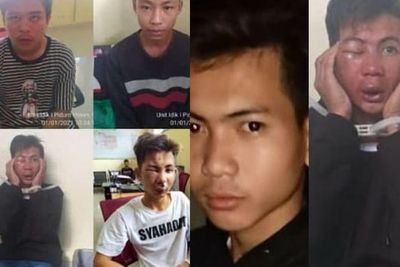 Tampang Pelaku yang Keroyok Anggota TNI Hingga Tewas, Wajah Bengkak Tak Berbentuk