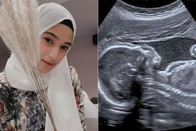 Nadya Mustika Rahayu Pamer Foto USG: Alhamdulillah, Sehat-sehat Ya Nak