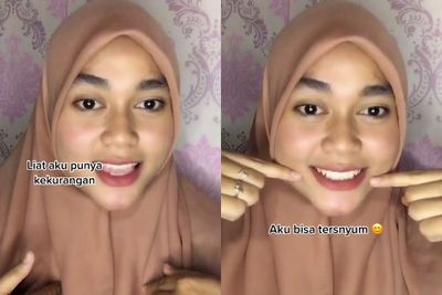 Meski Punya Kekurangan, Gadis Cantik Ini Ajarkan Cara Bersyukur, Videonya Bikin Haru