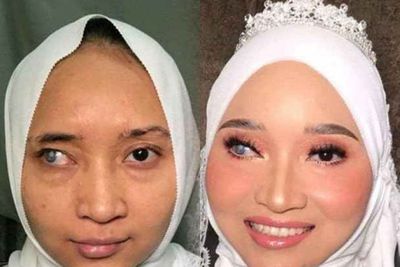 Power of Makeup! Wanita yang Punya Bekas Luka Ini Jadi Sangat Cantik Setelah Dirias