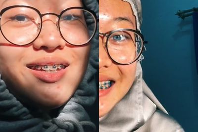 Unik! Wanita Ini Memiliki Dua Warna Mata Berbeda, Sering Dikira Pakai Softlens