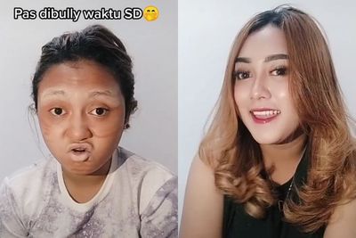 Dibully Waktu SD, Penampilan Wanita Ini Malah Bikin Netizen Pangling Usai Kenal Skincare