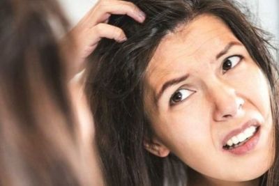 Ketombe Mengganggumu? Gunakan 3 Bahan Alami Ini Untuk Menghilangkannya!
