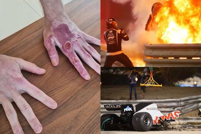 Bintang F1 Ini Tunjukkan Cedera Tangannya Usai Alami Kecelakaan saat Mobil Terbelah Dua