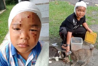 Meski Kepala & Wajah Dicakar hingga Diperban, Anak Ini Minta Ayahnya Tidak Memukul Kucing