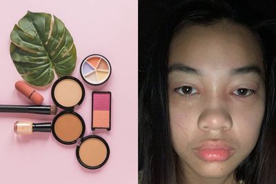 Wajah Wanita Ini Berakhir Bengkak dan Bernanah Setelah Pakai Makeup Expired