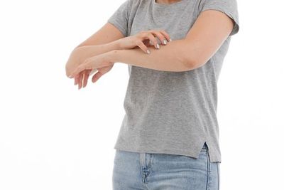 Tips Untuk Merawat Kulit Usai Terkena Cacar Air