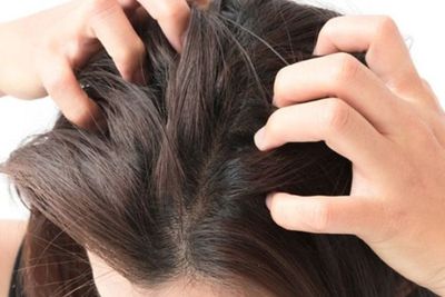 10 Cara Menghilangkan Jerawat di Kepala Secara Alami, Efektif!