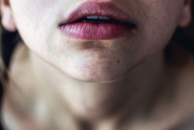 Mengapa Bibir Kita Bisa Kering? Berikut Penjelasannya