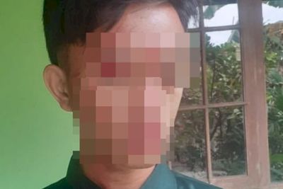 Viral Santri Berdarah-darah usai Ditegur Anak Kiai, Diduga karena Tak Salat Berjamaah