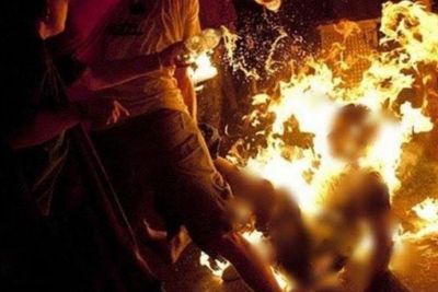 Heboh Suami Bakar Istri Hingga Alami Luka Bakar Hampir 70 Persen di Sumut