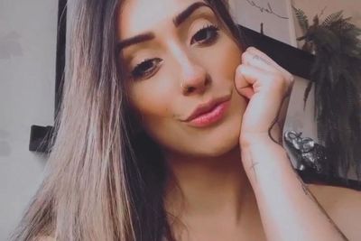 Model Asal Brasil Ini Diserang Mantan Pacarnya Sehari Setelah Diputuskan, Hidungnya Patah