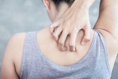 Kenali Back Acne dan Apa Penyebabnya Muncul di Badan!