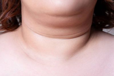 Cara Ampuh Menghilangkan Double Chin dengan Gerakan Sederhana