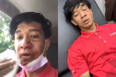 Pilu, Seorang Kurir Diterkam Anjing Galak Saat Antar Barang ke Pemilik Rumah