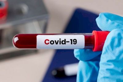Benarkah Tubuh Jadi Kebal Virus Setelah Sembuh dari Covid-19?