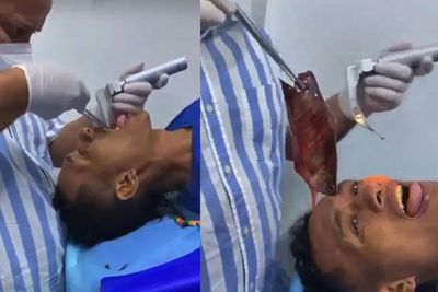 Gara-gara Serakah, Pria Ini Masukkan Ikan Hidup ke Mulut, Nyaris Tewas Kehabisan Napas