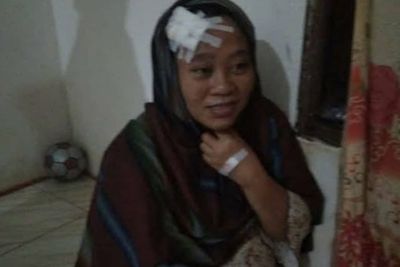 Wanita di Gowa Jadi Korban Peluru Nyasar Saat Sedang Asyik Nonton TV Bareng Anak