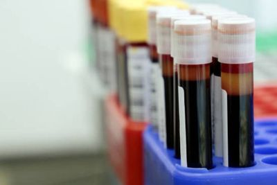 Mengenal Plasma Konvalesen, Terapi Pengobatan Pasien Covid-19