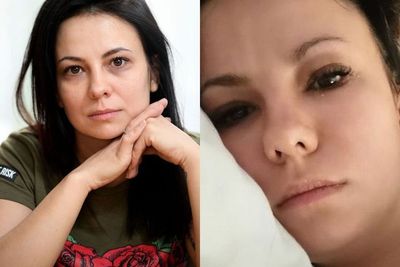 Wanita Ini Tak Bisa Kenali Dirinya di Cermin Sebelum Tahu Telah Menderita Tumor Otak