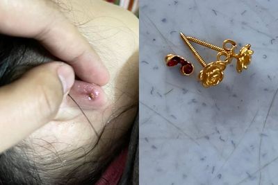 Wanita Ini Bagikan Pengalaman Mengerikan Anting Anaknya yang Terjebak di Telinga