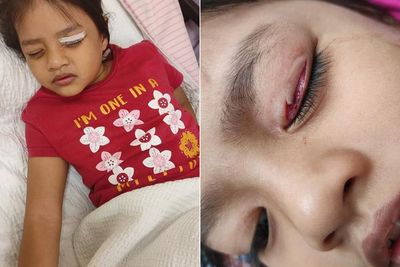 Anaknya Alami Cedera Mata, Ibu Ini Peringatkan Orangtua untuk Mengawasi Anak saat Bermain