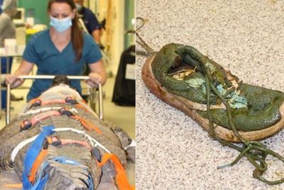 Telan Sneaker Pengunjung, Buaya di Florida Ini Terpaksa Naik Meja Operasi