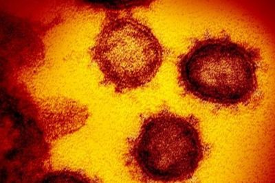 Lolos dari Antibodi, Varian Baru Corona Telah Menyebar ke 13 Negara