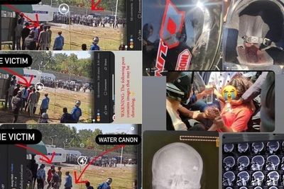 Detik-detik Peluru Menembus Helm Gadis Myanmar yang Ditembak di Kepala Saat Demo