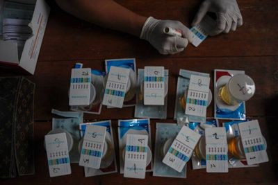 Soal Tes Urine Anggota Polisi Gegara Kompol Yuni Nyabu, Polri: Sudah Dilakukan