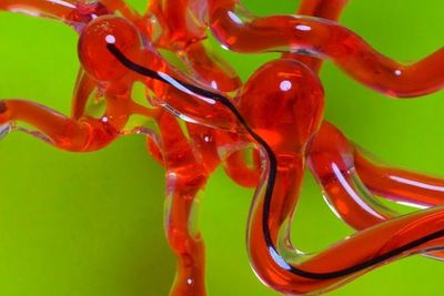 Peneliti MIT Berhasil Kembangkan Robot Kecil yang Bisa Masuk ke Pembuluh Darah
